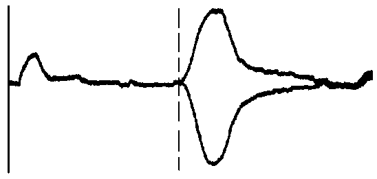 電纜終端開(kāi)路與短路脈沖反射波形比較 電纜終端開(kāi)路與短路脈沖反射波形比較